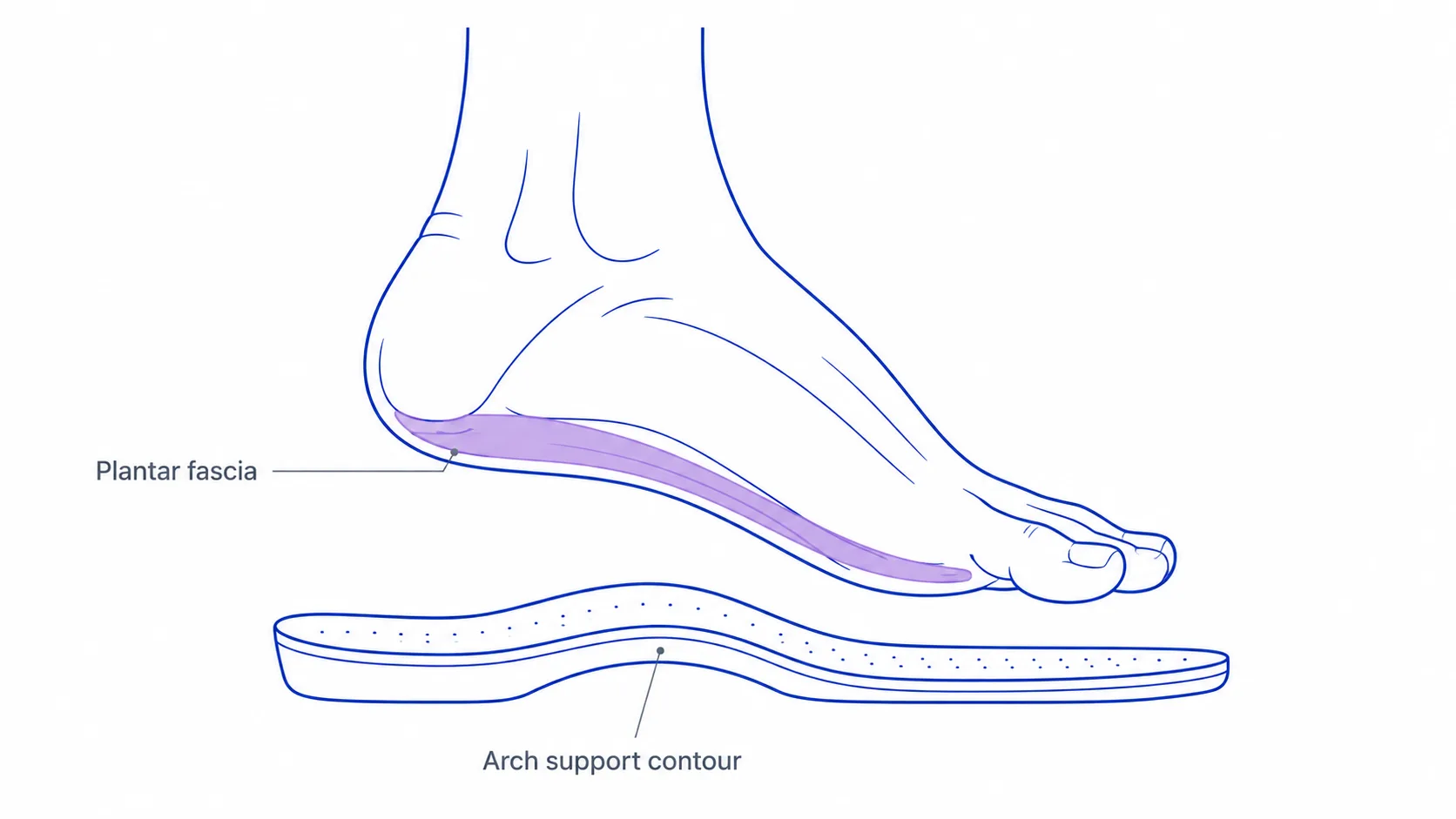 Individuelle Einlagen bei Plantarfasziitis — feste Gewölbestütze und tiefe Fersenschale zur Linderung von Fersenschmerz