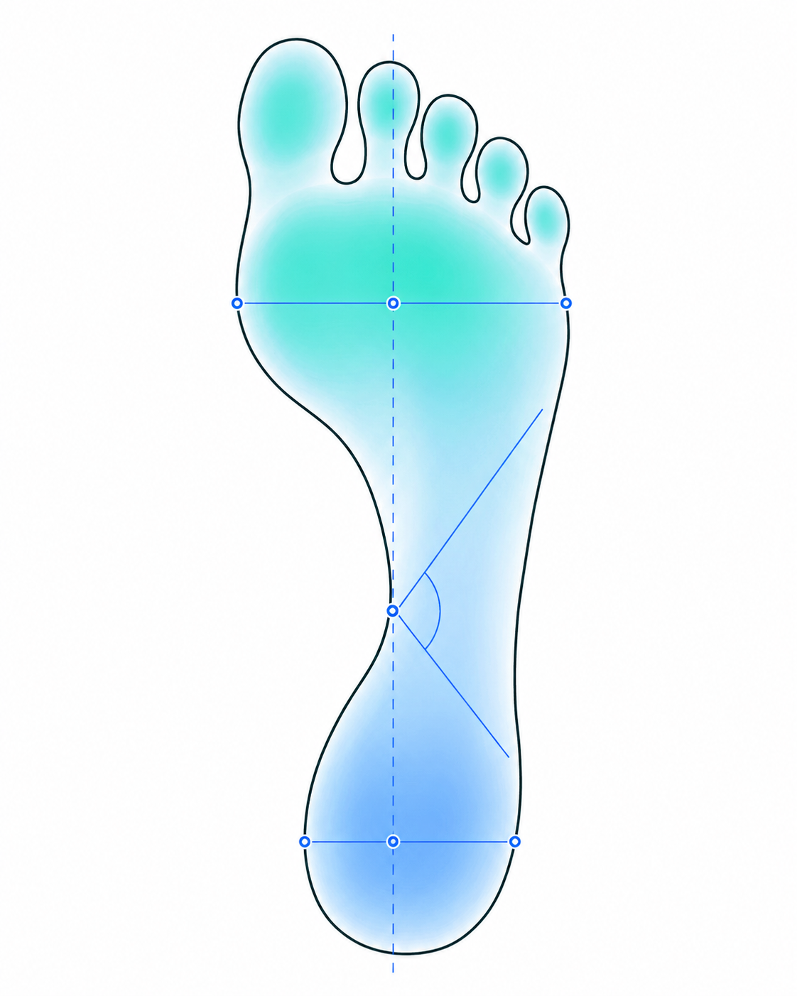 Plantar footprint with podoscopy measurement overlay — longitudinal axis, forefoot and heel width, and Clark angle